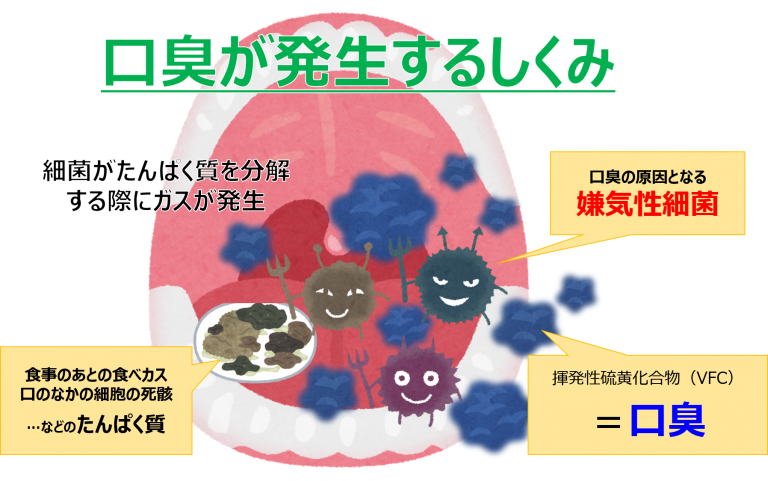 口臭の原因